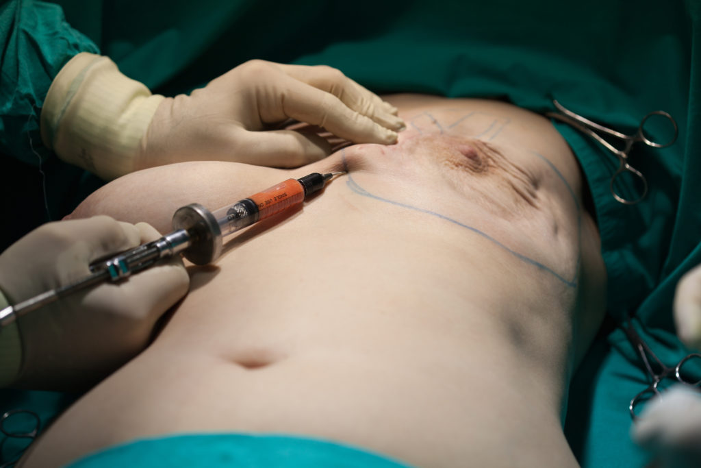 Breast Reconstruction Denver, CO